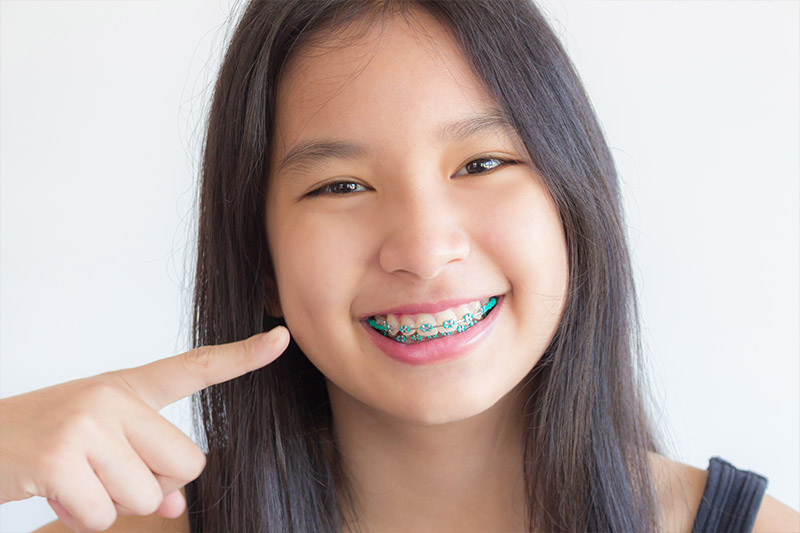 https://www.smilesbydryoon.com/images/dental-services/kids-orthodontics.jpg
